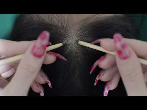ASMR Scalp Scratching Aggressive Real Person For Headache Relief ( Asmr No Talking )