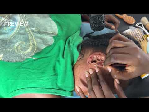 ASMR SATISFYING DEEP EAR NITPICKING CLEANING MASSAGE AND SCALP SCRATCH, BACK NITPICKING