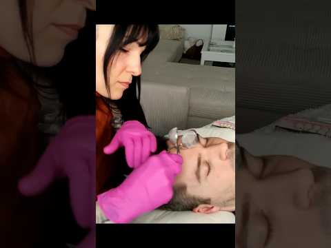 Special forehead treatment