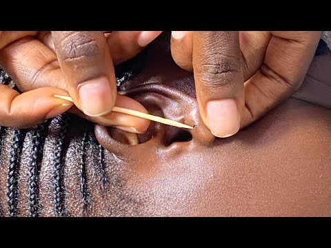 Asmr Come let me clean your ears, nitpicking your face and scratch your scalp for you to relax