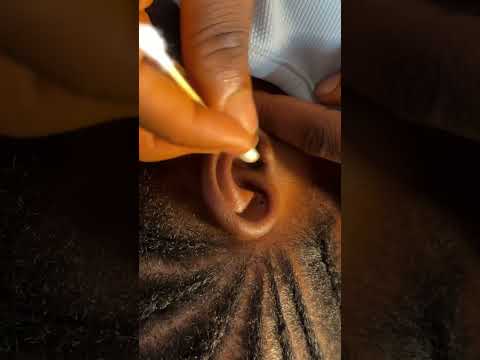 ASMR SCALP SCRATCHING AND EAR CLEANING, SCALP MASSAGE, EAR MASSAGE WITH AGGRESSIVE GUM CHEWING