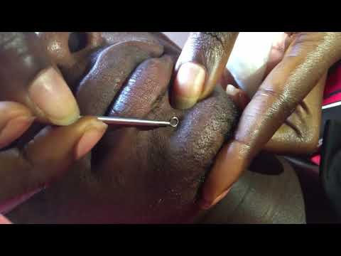 Asmr For Sleep #satisfying #nitpicking #asmrsleep #asmr