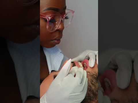 Took a KEEN look inside his mouth look what i found 👀 | FULL VIDEO ON OUR YOUTUBE CHANNEL #shorts