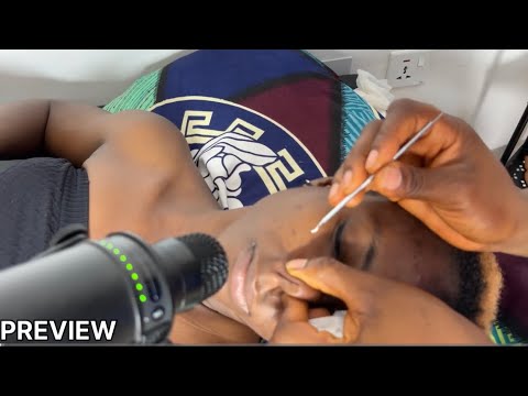 Up-Close Face Picking ASMR | Realistic Skin Sounds & Personal Attention for Sleep and Tingles