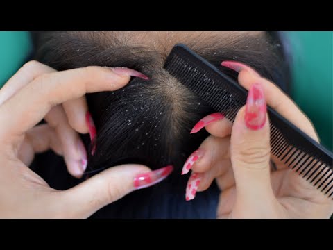 ASMR Dandruff Scratching / Routine Lightly Oiling For Scalp  / Scalp Care Relaxing For Sleep