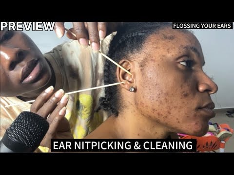 ASMR EAR CLEANING AND NITPICKING FLOSSING DIRTY EARS, BACK SCRATCHING AND HEAD SCRATCHING NITPICKING