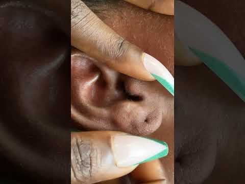 Asmr Sleep and relaxation nitpicking on a real person #asmr #relax #tingling