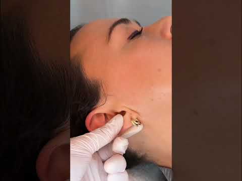 ASMR Ear Exam, Massage, Treatment 🩵 #asmr #asmrrealperson #asmrear #asmrmedical #asmrsounds