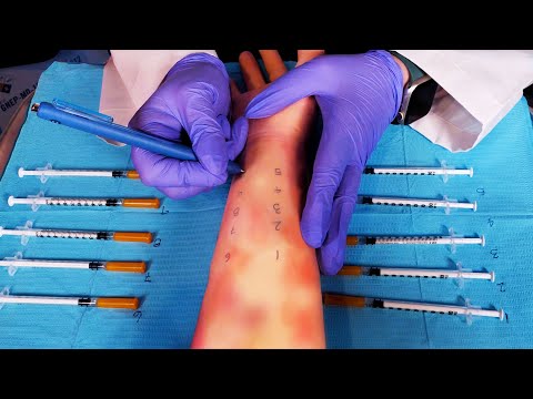 ASMR Hospital Allergy Testing | Severe Allergic Reaction