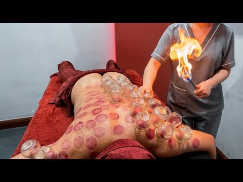 ASMR 🇻🇳 Fire Cupping Therapy in Vietnam 🔥 | Only $4 | Deep Relaxation