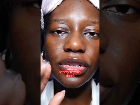 ASMR EMERGENCY SKIN CHECK ‼️🧤 #asmrtingles #asmrshorts #asmrskincare #asmr #asmrroleplay #asmrsleep