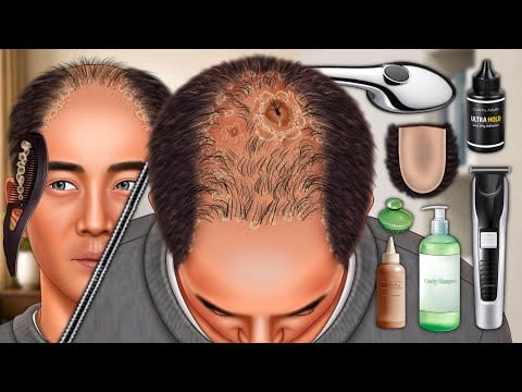 Flaky Scalp Treatment ASMR Animation, Relaxing Dandruff Removal and Hair Makeover ASMR Animation