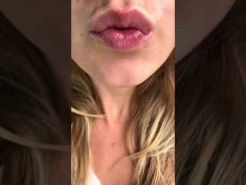 Kisses