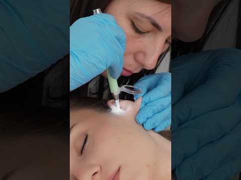 ASMR Ear Exam, Cleaning #roleplay #asmr #satisfying #relaxing #asmrsounds #relax #asmrvideo #shorts
