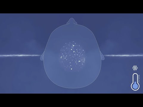서늘하다, 고막에 팅글이 날아와 꽂힌다. 𝗔𝗦𝗠𝗥