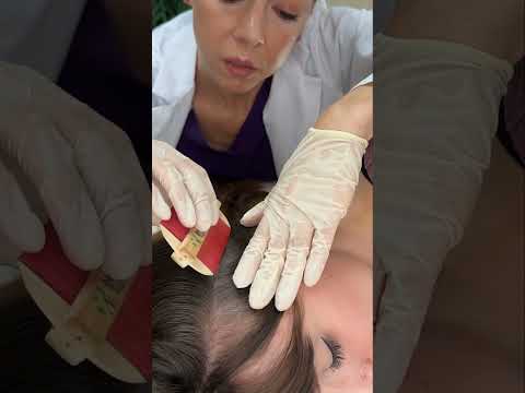 Asmr scalp tingles #asmr #asmrsounds #asmrvideo #relax #relaxing #satisfying #hair #sleep #tingles