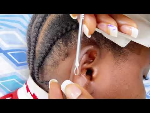 ASMR REAL PERSON GENTLE NITPICKING 👂