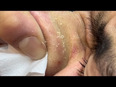 Detailed Skin Care ASMR Time (ADVERTISEMENT-FREE)