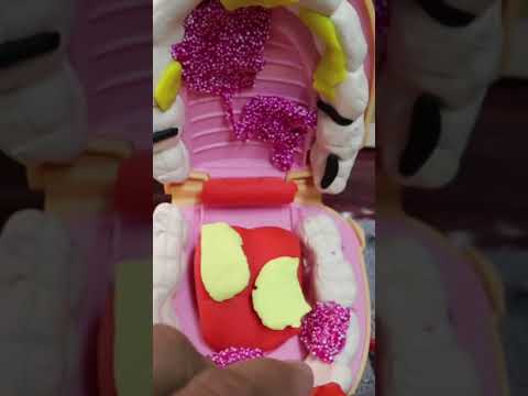 limpieza dental 🦷🤓 te quito el sarro 😨 #asmr #viral #shorts