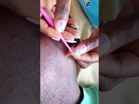 asmr ear massage roleplay #asmr #tingling #relax #satisfying #ear #relaxing