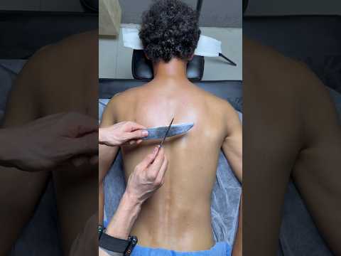 "asmr"vip cupping😍#viral #shorts #fyp #trendingshorts #viralshorts #explore #youtubeshorts