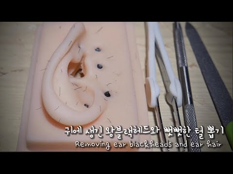 (주의) ㅅㅣ각적 ASMR 귀에 생긴 왕블랙헤드 짜기/귀에 난 수염 뽑기_롤플레이│Ear Blackhead Removal & Ear hair extraction roleplay