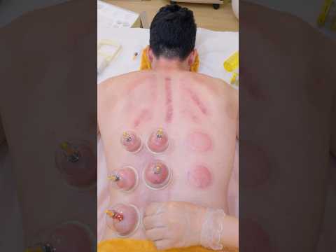 ASMR: She did EVERYTHING - Shave, Massage, Cupping, Guasha, Hot Stones, Shampoo & More! #shorts