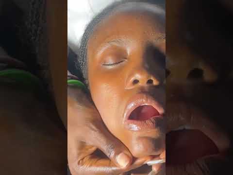 ASMR FAST AND AGGRESSIVE FACE, MOUTH, SCALP BRAID MASSAGE AND SCRATCHING FOR SLEEP, GUM CHEWING