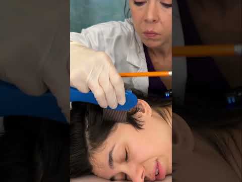 Asmr scalp tingles #asmr #asmrsounds #asmrvideo #relax #relaxing #satisfying #hair #sleep #tingles