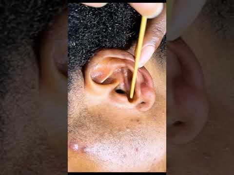 ASMR Ear Piercing Cleaning, Armpit Washing & Lymphatic Foot Body Massage for Deep Relaxation & Sleep