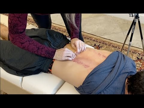 SKIN CRACKING for BACK CRACKS ~ BELIEVED IT WAS GOING TO HURT!