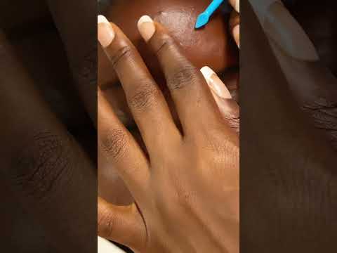 ASMR NITPICKING HER FACE #asmr #relax #satisfying #tingling