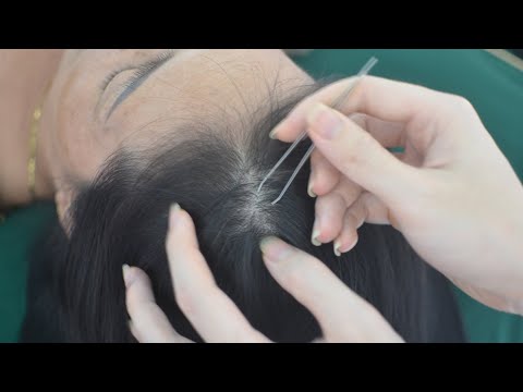 ASMR Nape Scratching Real Person Aggressive Hair Parting, Tingly For Stress Relief