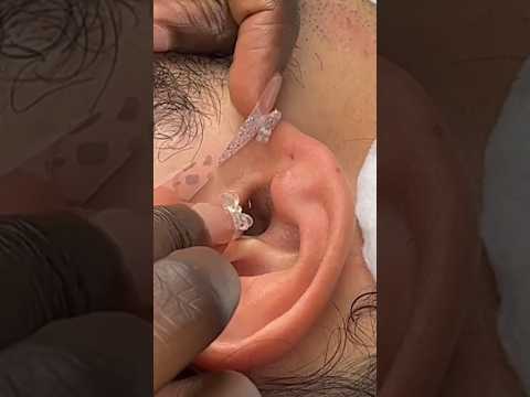 Ear cleaning like you have never seen | full video on our channel  #asmr #shorts #youtubeshorts