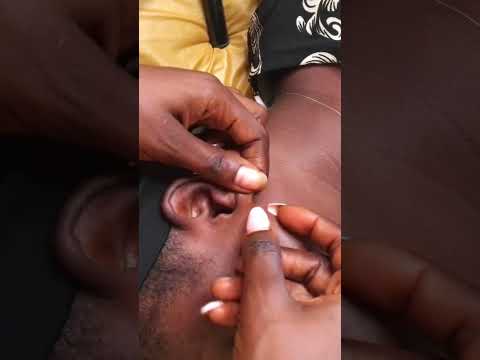 ASMR ALLURING NECK, EAR, FACE MASSAGE &NITPICKING #satisfying #nitpicking #asmr