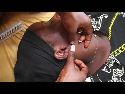 ASMR ATTENTIVE EAR EXAM DEEP EAR CLEANING WITH BUBBLEGUM