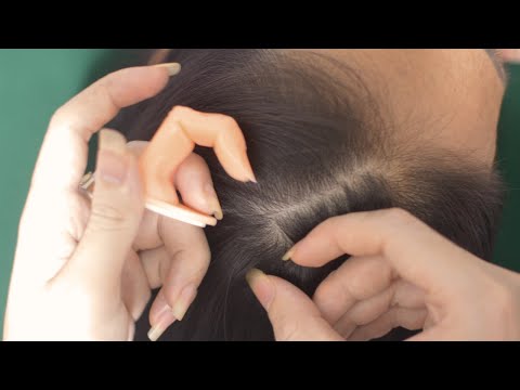 ASMR Aggressive Scratching Scalp, Relaxing Hair Parting, Hair Massage For Headache Relief