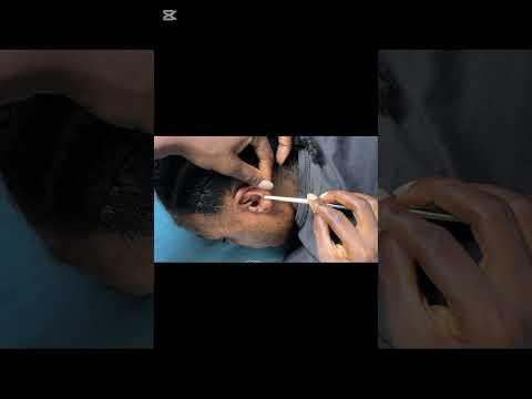 Ear cleaning and picking for sleep very satisfying #relax #asmrearcleaning