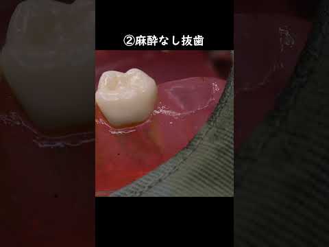 こんな歯科医さんは嫌だあ🔥どこまで耐えられますか？🦷👨‍⚕️ASMR