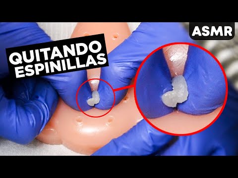 ASMR Español EXPRIMIENDO Espinillas de tu Nariz *Satisfactorio para Dormir - ASMR Español - ASMR