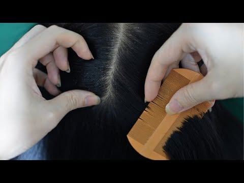 ASMR Scalp Check, Scalp Scratching Real Person For Sleep And Relieve Stress
