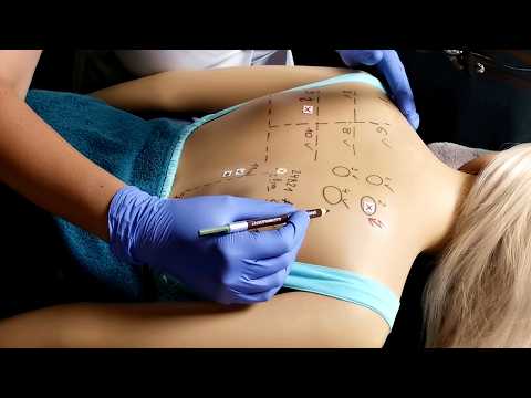 Back Exam, Soft Touches & Allergy Test (Whispered)