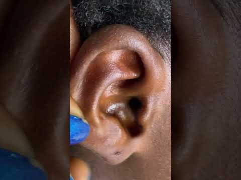 Asmr a rare ear nitpicking #satisfying #asmr #relax