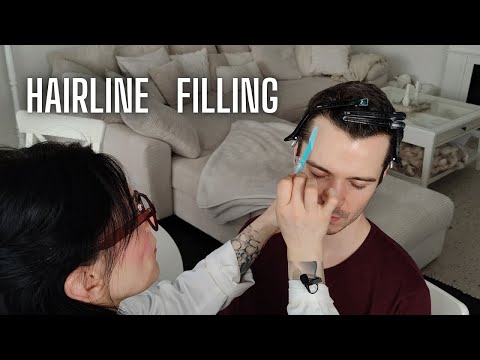 ASMR Full Process Of Hairline Examination & Filling