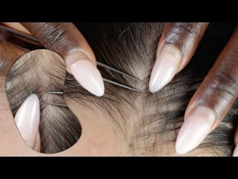 The BEST SLEEP of his life scalp scratching | nitpicking 