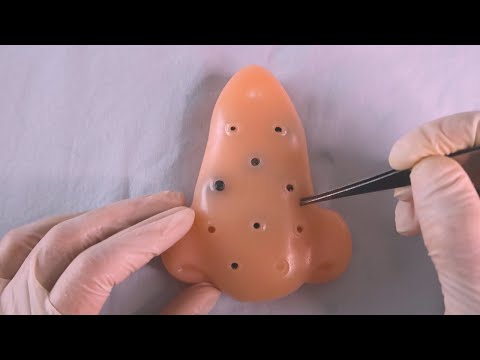 ASMR | EXTRAÇÃO DE CRAVOS GIGANTES DO SEU NARIZ