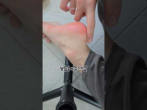 썸남이 만져보고 놀란 내 발뒤꿈치..?