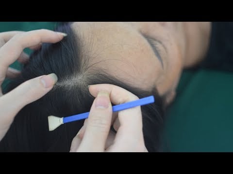 ASMR Real Person Hair Parting, Hair Combing & Head Scratch For Relieve Anxiety, Stress