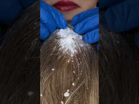 ASMR Hair Cleaning 💆🏻‍♀️ #asmr #relax #visualtingle #satisfying #tingles #relaxing #asmrscratching