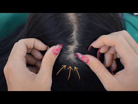 ASMR Dandruff Scratching With Long Nails For Relaxation ( Scalp Check, Scalp Scratching ) No Talking